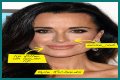 Botox, Implants & More! – Hollywood Life